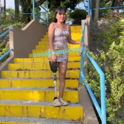 Kisha with prosthesis