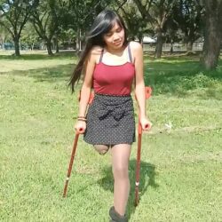 Kisha crutching at the Park