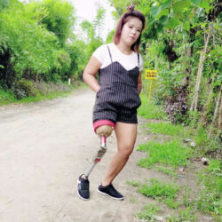 Ms Zhed walking with prosthesis 4k