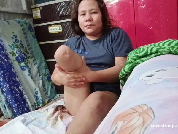 Mia Chan stump massage