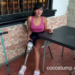 Kisha walk with prosthesis