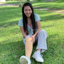 Xialyn walk with prosthesis